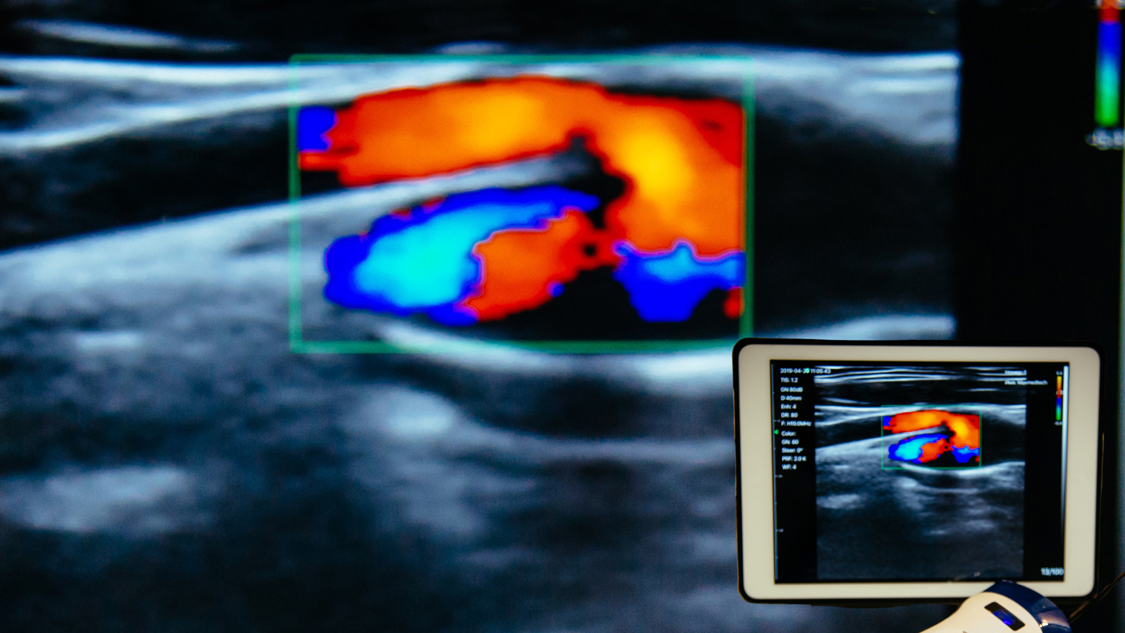 Desenvolvimento de Imagens Biomédicas em Tempo Real Utilizando Tiny Machine